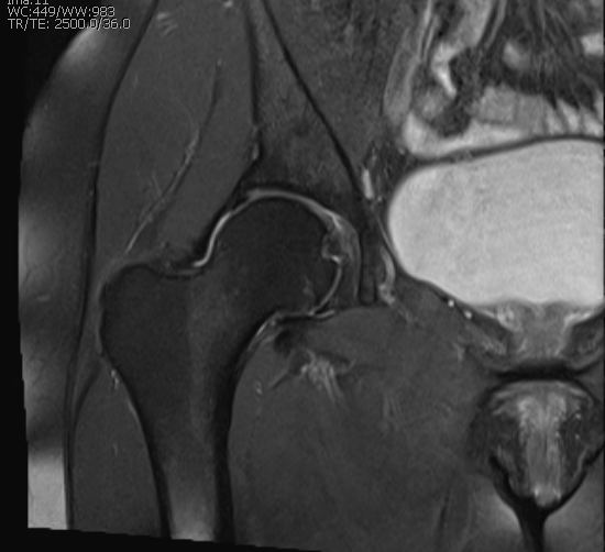 Ressonância Magnética com Espectroscopia 